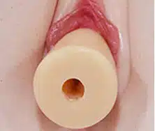Insert