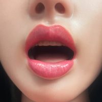 Normal